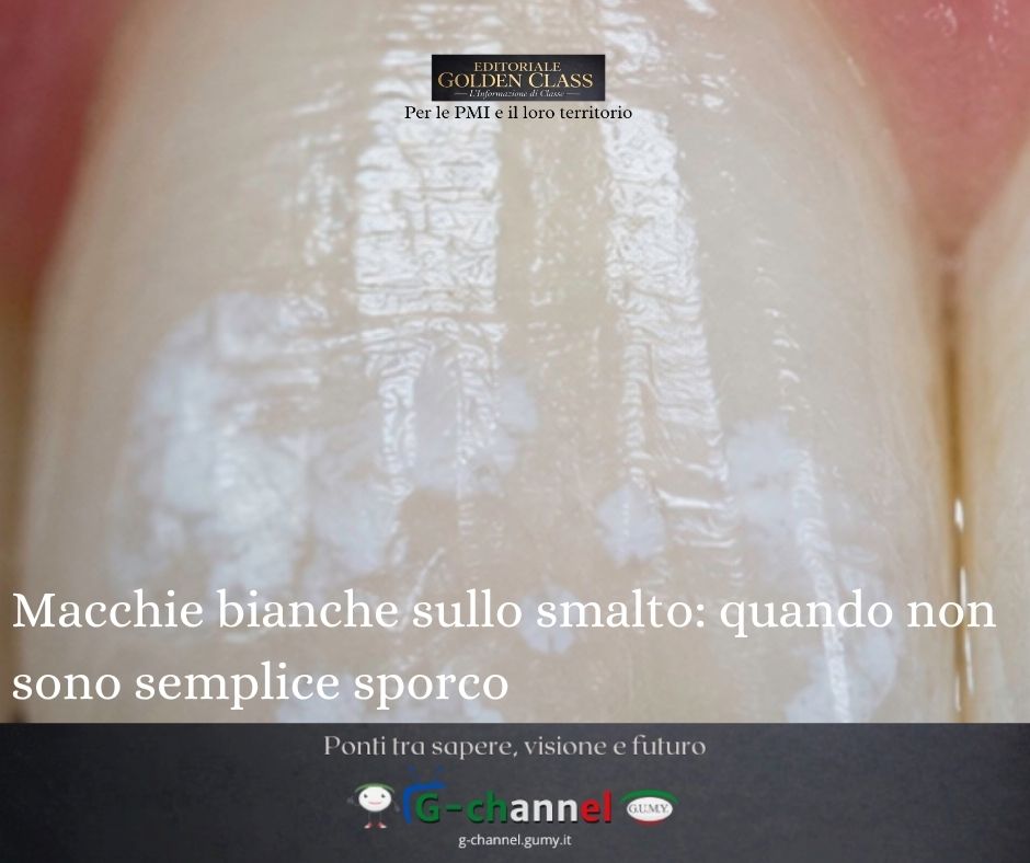 Macchie bianche sullo smalto: quando non sono semplice sporco